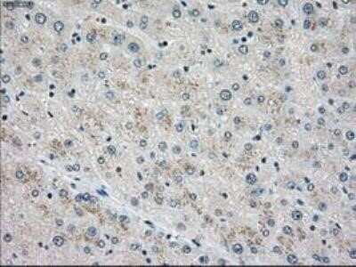 Immunohistochemistry: MST2/STK3 Antibody (OTI4G10) - Azide and BSA Free [NBP2-72794]