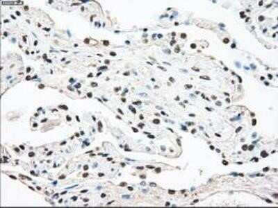 Immunohistochemistry: MST2/STK3 Antibody (OTI4G10) - Azide and BSA Free [NBP2-72794]