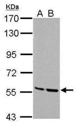 Western Blot: MST2/STK3 Antibody [NBP1-32313]