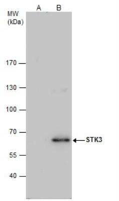 Western Blot: MST2/STK3 Antibody [NBP2-19421]