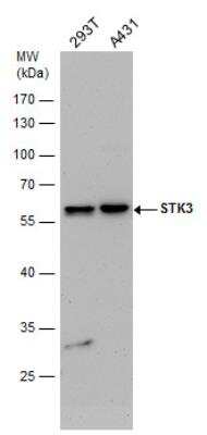 Western Blot: MST2/STK3 Antibody [NBP2-19421]