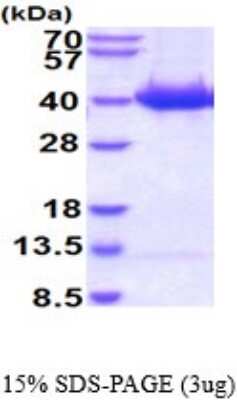 SDS-PAGE: Recombinant Human MST2/STK3 His Protein [NBP2-53049]