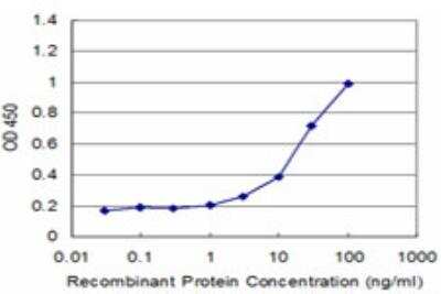 ELISA: MST3 Antibody (3F2) [H00008428-M04]
