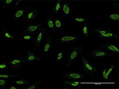 Immunocytochemistry/ Immunofluorescence: MST3 Antibody (3F2) [H00008428-M04]