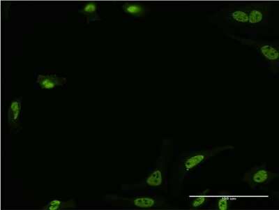 Immunocytochemistry/ Immunofluorescence: MST3 Antibody (4G5) [H00008428-M03]