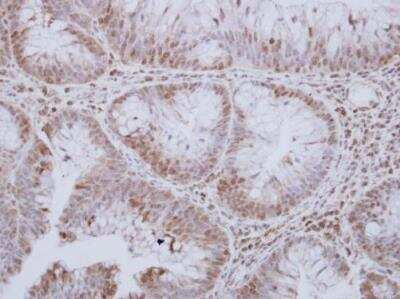 Immunohistochemistry-Paraffin: MST3 Antibody [NBP1-31360]