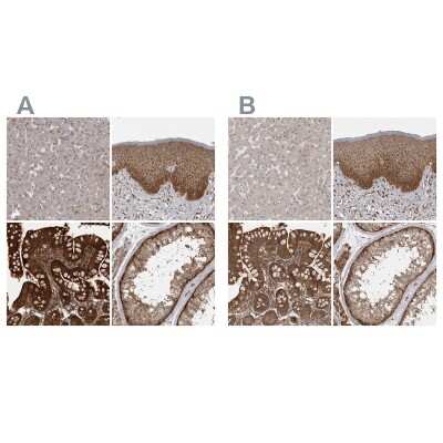 Immunohistochemistry-Paraffin: MST3 Antibody [NBP1-87833]