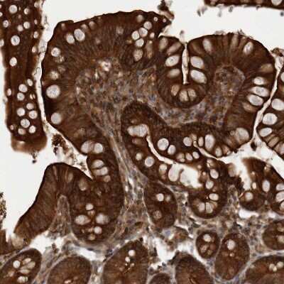 Immunohistochemistry-Paraffin: MST3 Antibody [NBP1-87833]