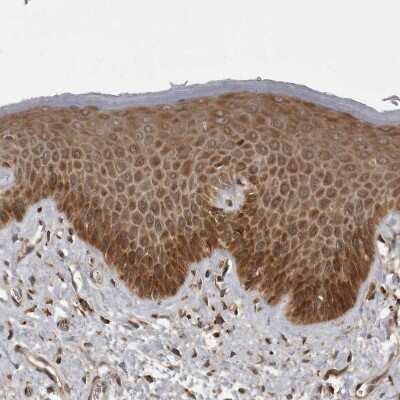 Immunohistochemistry-Paraffin: MST3 Antibody [NBP1-87833]