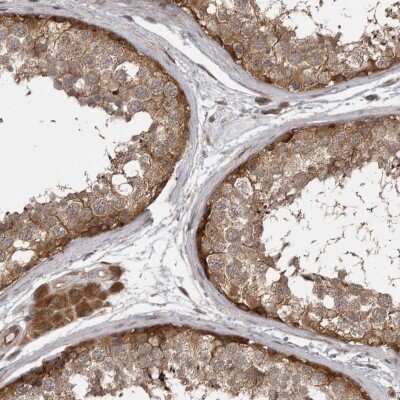 Immunohistochemistry-Paraffin: MST3 Antibody [NBP1-87834]