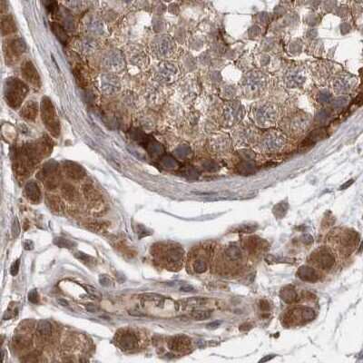 Immunohistochemistry-Paraffin: MST3 Antibody [NBP1-87834]