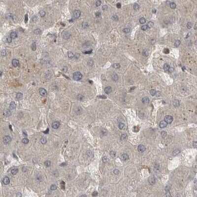 Immunohistochemistry-Paraffin: MST3 Antibody [NBP1-87834]