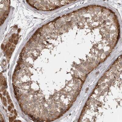 Immunohistochemistry-Paraffin: MST3 Antibody [NBP1-87834]