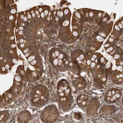 Immunohistochemistry-Paraffin: MST3 Antibody [NBP1-87834]
