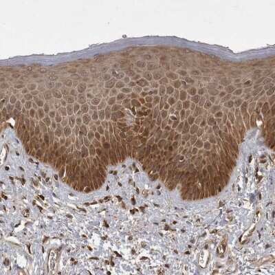 Immunohistochemistry-Paraffin: MST3 Antibody [NBP1-87834]