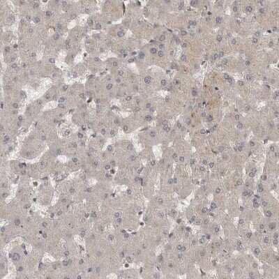 Immunohistochemistry-Paraffin: MST3 Antibody [NBP1-87834]