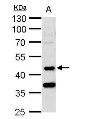 Western Blot: MST3 Antibody [NBP1-31360]