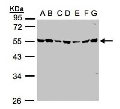 Western Blot: MST3 Antibody [NBP1-31575]