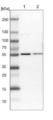 Western Blot: MST3 Antibody [NBP1-87833]