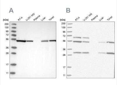 Western Blot: MST3 Antibody [NBP1-87833]