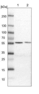 Western Blot: MST3 Antibody [NBP1-87834]