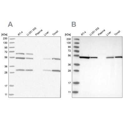 Western Blot: MST3 Antibody [NBP1-87834]