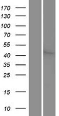 Western Blot: MST3 Overexpression Lysate [NBP2-10596]