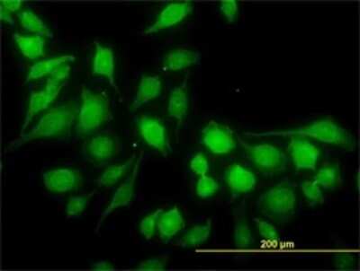Immunocytochemistry/ Immunofluorescence: MST4 Antibody (7H4) [H00051765-M02]