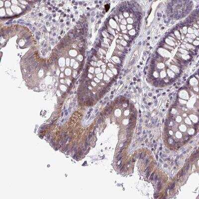 Immunohistochemistry-Paraffin: MST4 Antibody [NBP2-38882]