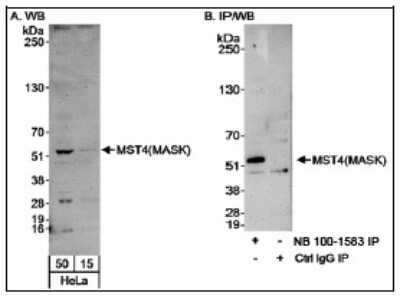 Western Blot: MST4 Antibody [NB100-1584]