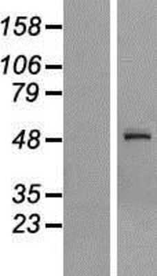 Western Blot: MST4 Overexpression Lysate [NBP2-07020]