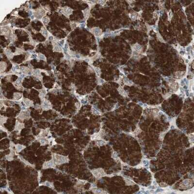 Immunohistochemistry-Paraffin: MSTO1 Antibody [NBP2-33860]