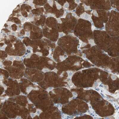 Immunohistochemistry: MSTO1 Antibody [NBP2-34201]