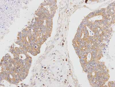 Immunohistochemistry-Paraffin: MSTO1 Antibody [NBP1-32254]