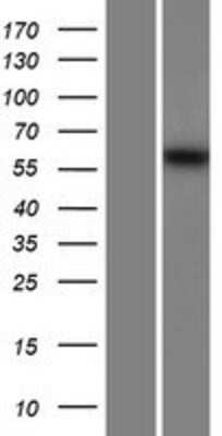 Western Blot: MSTO1 Overexpression Lysate [NBP2-06873]