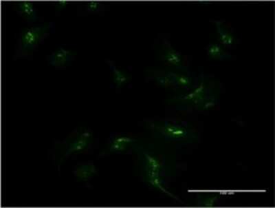 Immunocytochemistry/ Immunofluorescence: MSX1 Antibody (1E2) [H00004487-M11]