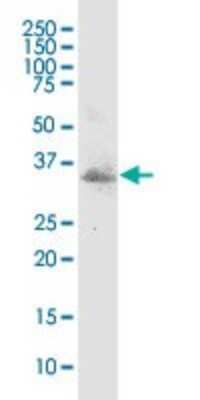 Western Blot: MSX1 Antibody (1E2) [H00004487-M11]