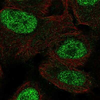 Immunocytochemistry/ Immunofluorescence: MSX1 Antibody [NBP2-57021]