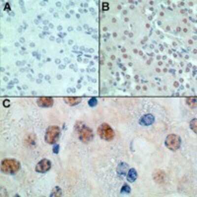Immunohistochemistry-Paraffin: MSX1 Antibody [NBP2-24715]