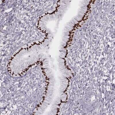 Immunohistochemistry-Paraffin: MSX1 Antibody [NBP2-57969]