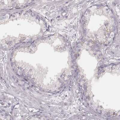 Immunohistochemistry-Paraffin: MSX1 Antibody [NBP2-57969]
