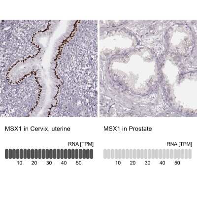 Immunohistochemistry-Paraffin: MSX1 Antibody [NBP2-57969]