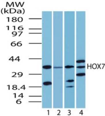 Western Blot: MSX1 Antibody [NBP2-24715]