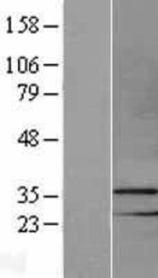 Western Blot: MSX1 Overexpression Lysate [NBL1-13341]