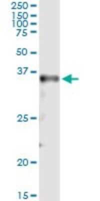 Immunoprecipitation: MSX2 Antibody (1E8) [H00004488-M10]