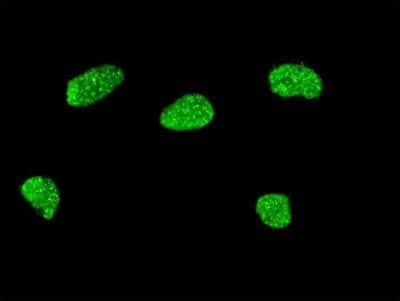 Immunocytochemistry/ Immunofluorescence: MSX2 Antibody (1F6) [H00004488-M04]