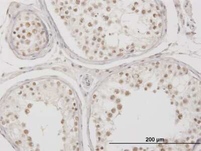 Immunohistochemistry-Paraffin: MSX2 Antibody (1F6) [H00004488-M04]