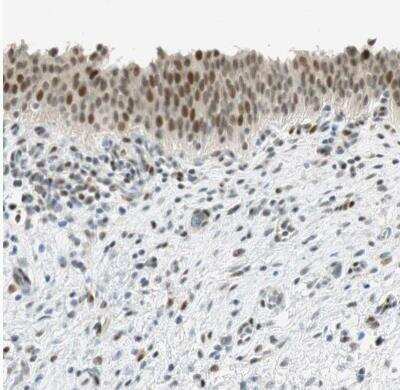 Immunohistochemistry-Paraffin: MSX2 Antibody [NBP1-85445]
