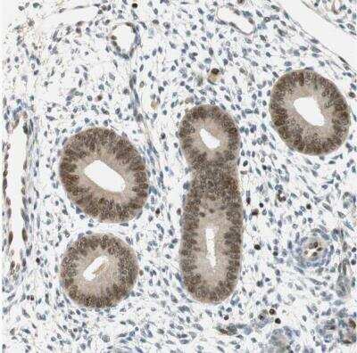 Immunohistochemistry-Paraffin: MSX2 Antibody [NBP1-85445]