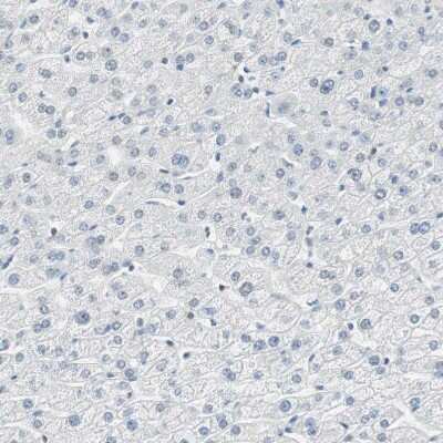 Immunohistochemistry-Paraffin: MSX2 Antibody [NBP1-85445]
